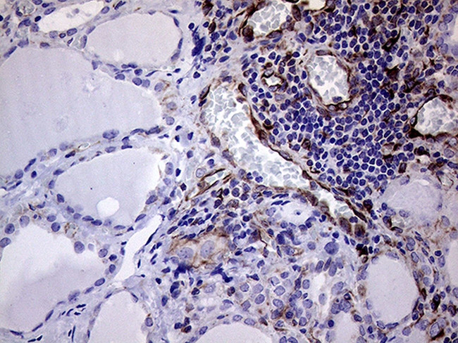 MLPH Antibody in Immunohistochemistry (Paraffin) (IHC (P))