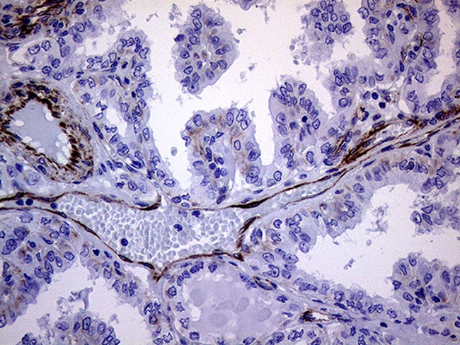 MLPH Antibody in Immunohistochemistry (Paraffin) (IHC (P))