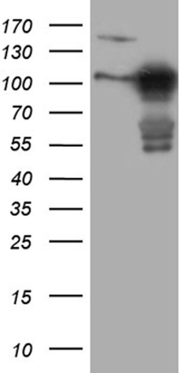 MLPH Antibody in Western Blot (WB)