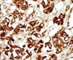 ZAK Antibody in Immunohistochemistry (IHC)