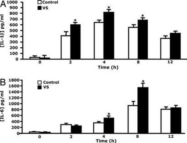 IL-1 beta Antibody in ELISA (ELISA)