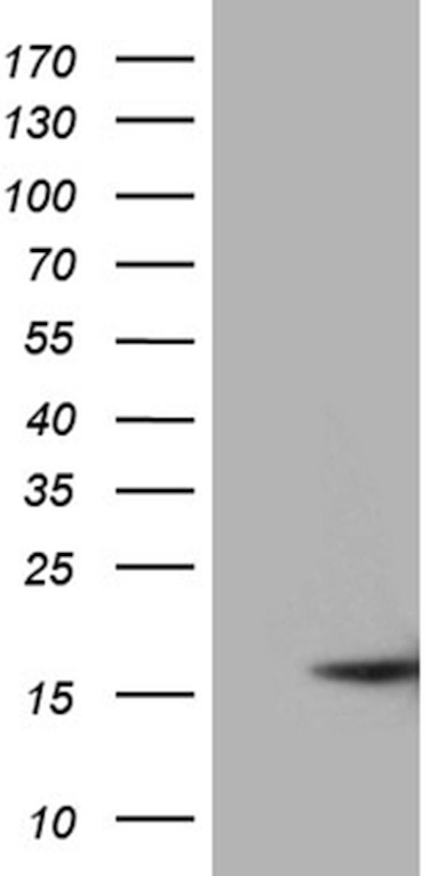 MMGT1 Antibody in Western Blot (WB)