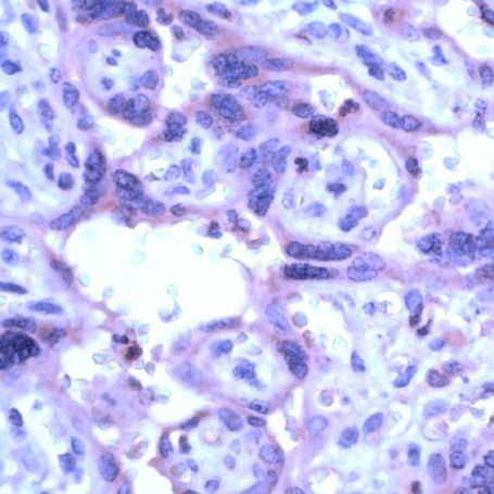 MMP19 Antibody in Immunohistochemistry (IHC)