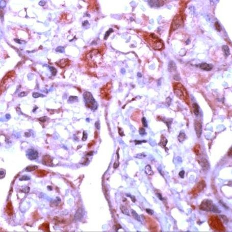 MMP1 Antibody in Immunohistochemistry (IHC)