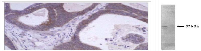 MMP1 Antibody in Immunohistochemistry (Paraffin) (IHC (P))