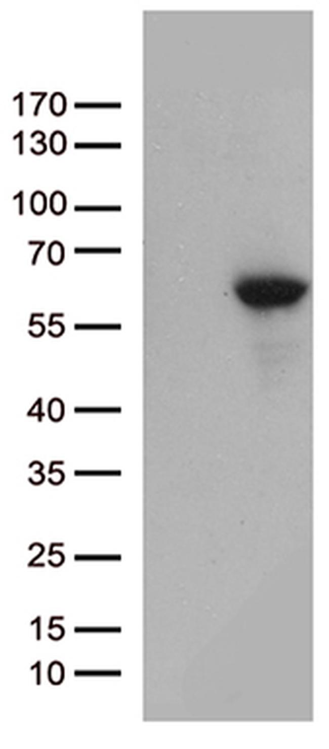 MMP11 Antibody in Western Blot (WB)