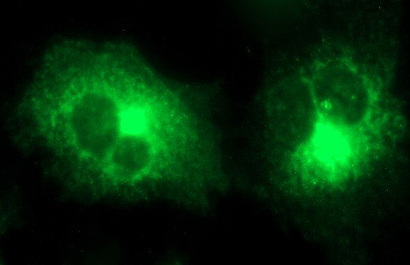 MMP13 Antibody in Immunocytochemistry (ICC/IF)