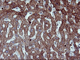 MMP13 Antibody in Immunohistochemistry (Paraffin) (IHC (P))