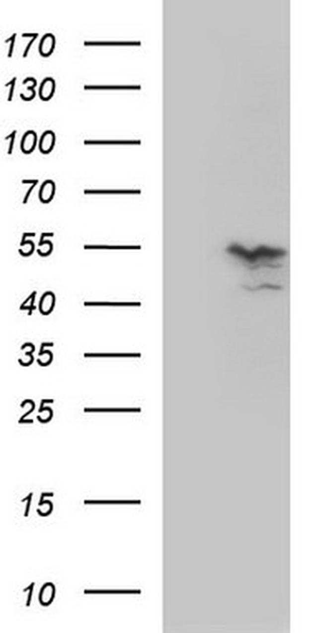 MMP13 Antibody in Western Blot (WB)