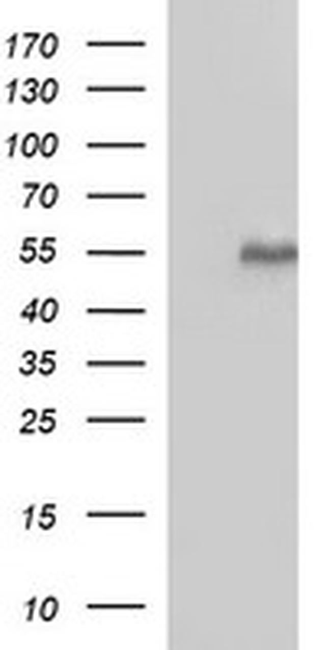 MMP13 Antibody in Western Blot (WB)