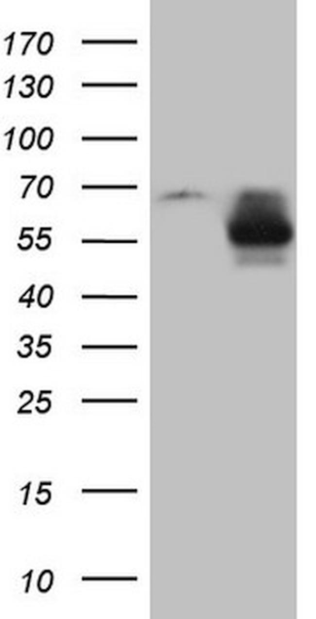 MMP3 Antibody in Western Blot (WB)