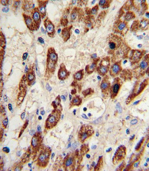 MMP3 Antibody in Immunohistochemistry (IHC)