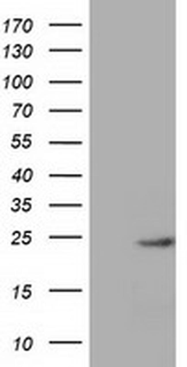 MOBKL1A Antibody in Western Blot (WB)