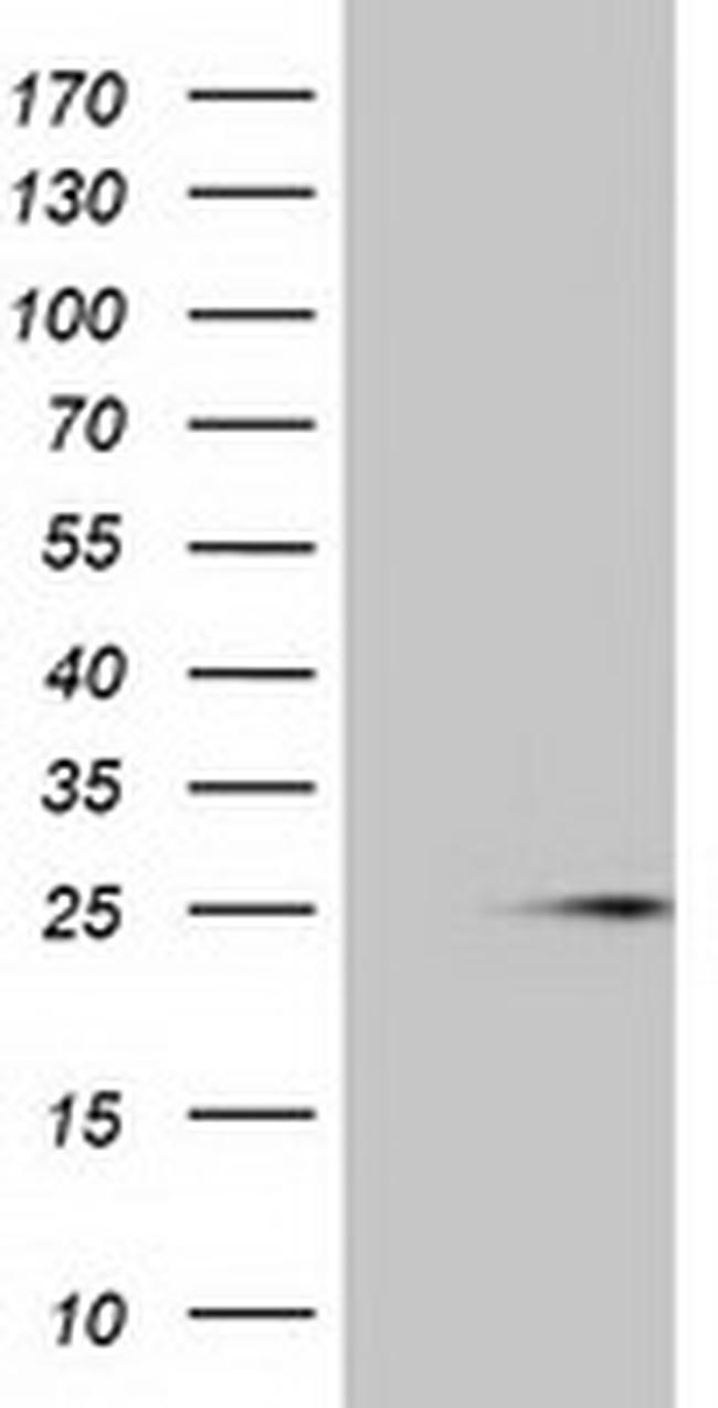 MOBKL1A Antibody in Western Blot (WB)