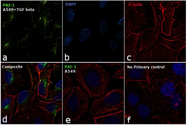 PAI1 Antibody