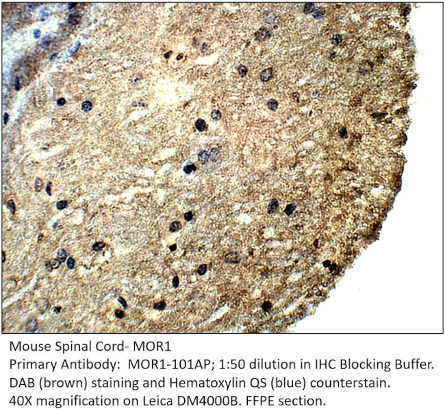 MOR1 Antibody in Immunohistochemistry (IHC)