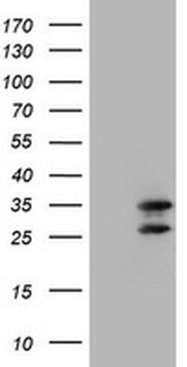 MORF4 Antibody in Western Blot (WB)