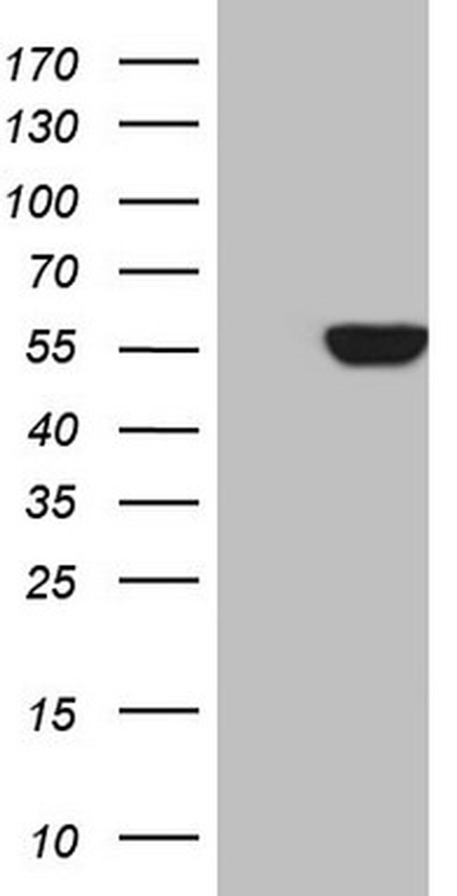MPP6 Antibody in Western Blot (WB)