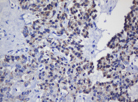 MRPL11 Antibody in Immunohistochemistry (Paraffin) (IHC (P))