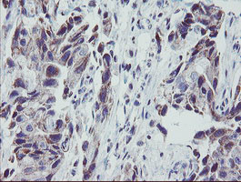 MRPS27 Antibody in Immunohistochemistry (Paraffin) (IHC (P))