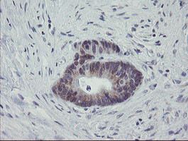 MRPS27 Antibody in Immunohistochemistry (Paraffin) (IHC (P))