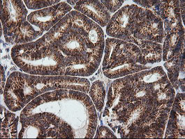 MRPS34 Antibody in Immunohistochemistry (Paraffin) (IHC (P))