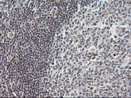 MRPS34 Antibody in Immunohistochemistry (Paraffin) (IHC (P))