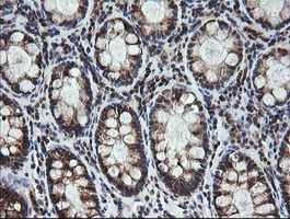 MRPS34 Antibody in Immunohistochemistry (Paraffin) (IHC (P))