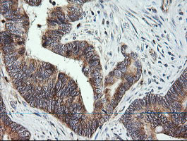 MRPS34 Antibody in Immunohistochemistry (Paraffin) (IHC (P))