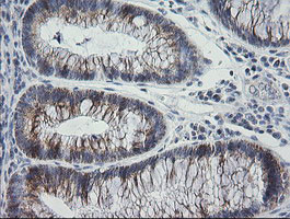 MRPS34 Antibody in Immunohistochemistry (Paraffin) (IHC (P))