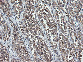 MRPS34 Antibody in Immunohistochemistry (Paraffin) (IHC (P))