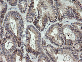 MRPS34 Antibody in Immunohistochemistry (Paraffin) (IHC (P))