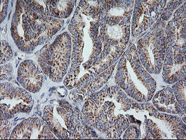 MRPS34 Antibody in Immunohistochemistry (Paraffin) (IHC (P))