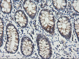 MRPS34 Antibody in Immunohistochemistry (Paraffin) (IHC (P))