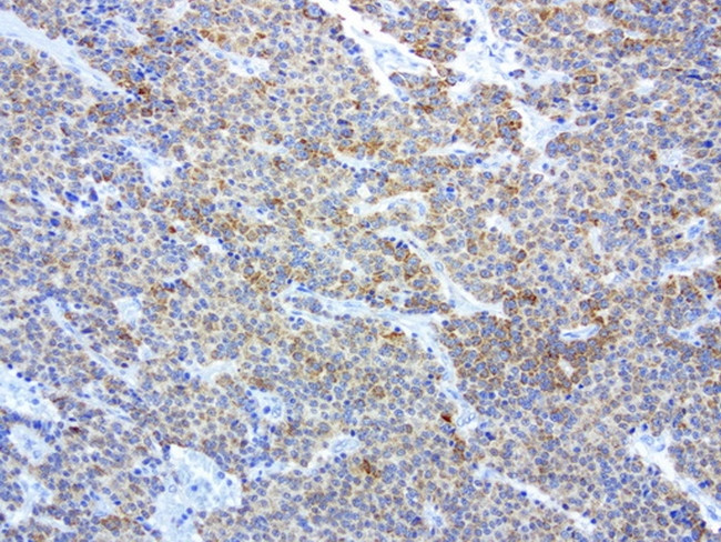 MRPS34 Antibody in Immunohistochemistry (Paraffin) (IHC (P))