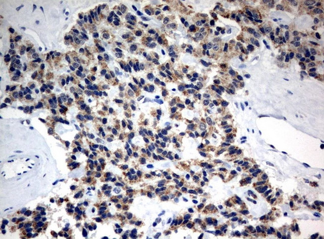 MRPS34 Antibody in Immunohistochemistry (Paraffin) (IHC (P))