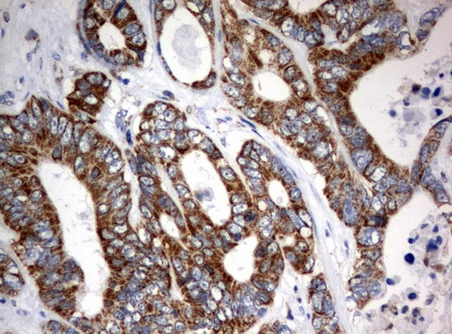 MRPS34 Antibody in Immunohistochemistry (Paraffin) (IHC (P))