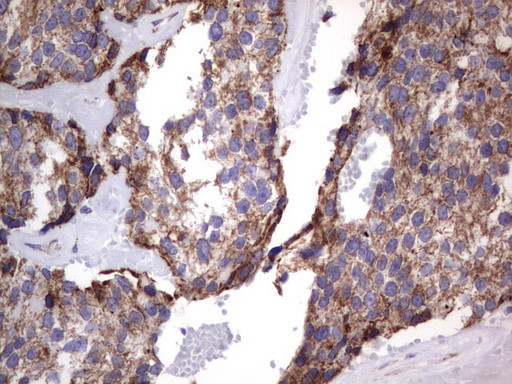 MRPS7 Antibody in Immunohistochemistry (Paraffin) (IHC (P))