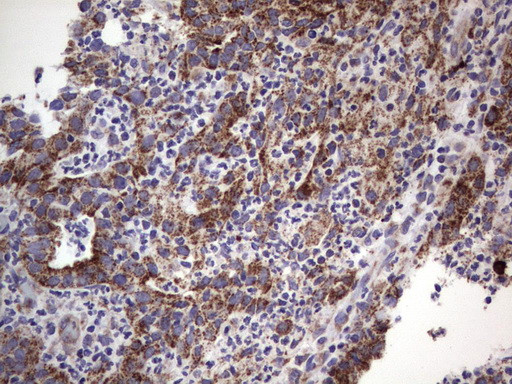 MRPS7 Antibody in Immunohistochemistry (Paraffin) (IHC (P))