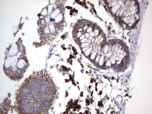 MRPS7 Antibody in Immunohistochemistry (Paraffin) (IHC (P))