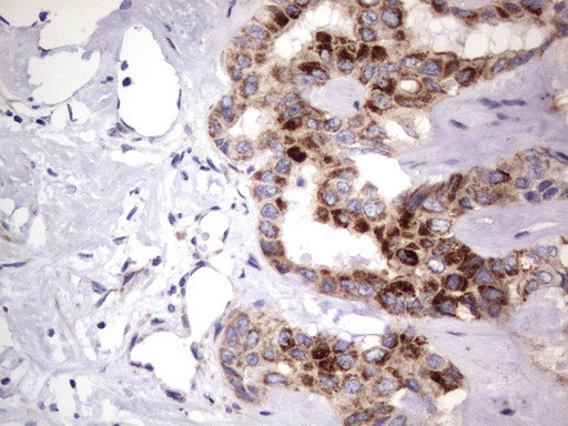 MRPS7 Antibody in Immunohistochemistry (Paraffin) (IHC (P))