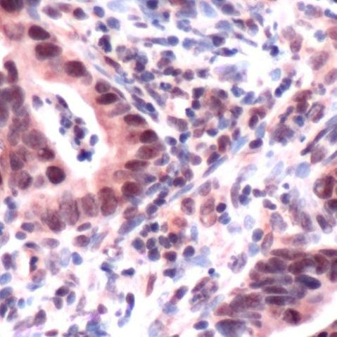 MSH3 Antibody in Immunohistochemistry (Paraffin) (IHC (P))