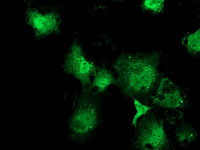 MSI1 Antibody in Immunocytochemistry (ICC/IF)