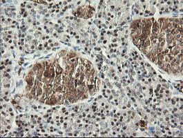 MSI1 Antibody in Immunohistochemistry (Paraffin) (IHC (P))