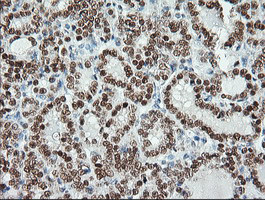 MSI1 Antibody in Immunohistochemistry (Paraffin) (IHC (P))