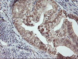 MSI1 Antibody in Immunohistochemistry (Paraffin) (IHC (P))