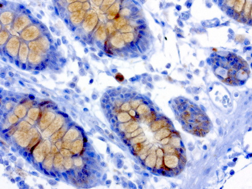 MSI1 Antibody in Immunohistochemistry (Paraffin) (IHC (P))