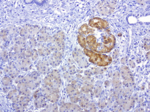 MSI1 Antibody in Immunohistochemistry (Paraffin) (IHC (P))