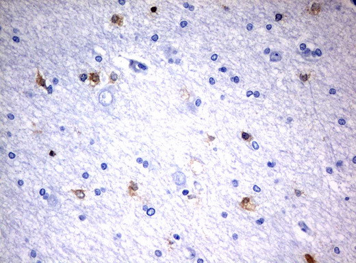 MSI1 Antibody in Immunohistochemistry (Paraffin) (IHC (P))