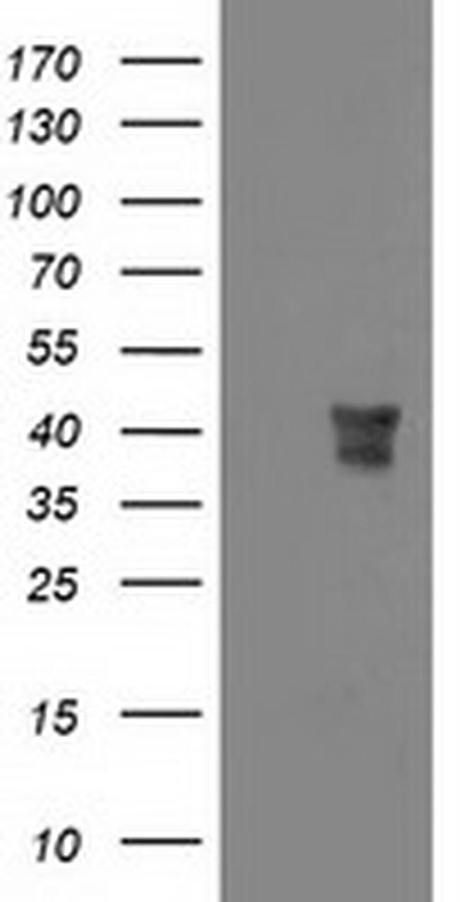 MSI1 Antibody in Western Blot (WB)